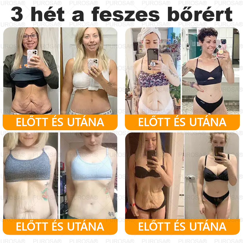 🐝 🎁 Már csak az utolsó 5 doboz maradt! Korlátozott ideig extra 50% kedvezmény! Ragadd meg a lehetőséget a bőröd újjászületéséhez ✨ Ha most lemaradsz, legközelebb csak jövőre lesz esélyed!
