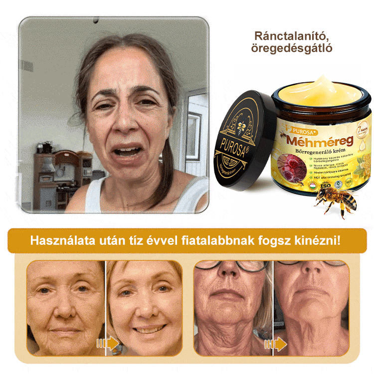 🐝 🎁 Már csak az utolsó 5 doboz maradt! Korlátozott ideig extra 50% kedvezmény! Ragadd meg a lehetőséget a bőröd újjászületéséhez ✨ Ha most lemaradsz, legközelebb csak jövőre lesz esélyed!