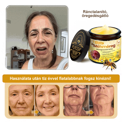 🐝 🎁 Már csak az utolsó 5 doboz maradt! Korlátozott ideig extra 50% kedvezmény! Ragadd meg a lehetőséget a bőröd újjászületéséhez ✨ Ha most lemaradsz, legközelebb csak jövőre lesz esélyed!