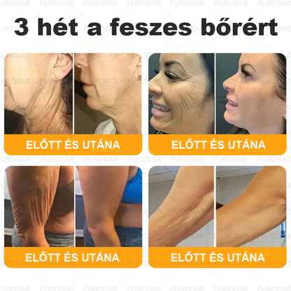 🐝 🎁 Már csak az utolsó 5 doboz maradt! Korlátozott ideig extra 50% kedvezmény! Ragadd meg a lehetőséget a bőröd újjászületéséhez ✨ Ha most lemaradsz, legközelebb csak jövőre lesz esélyed!